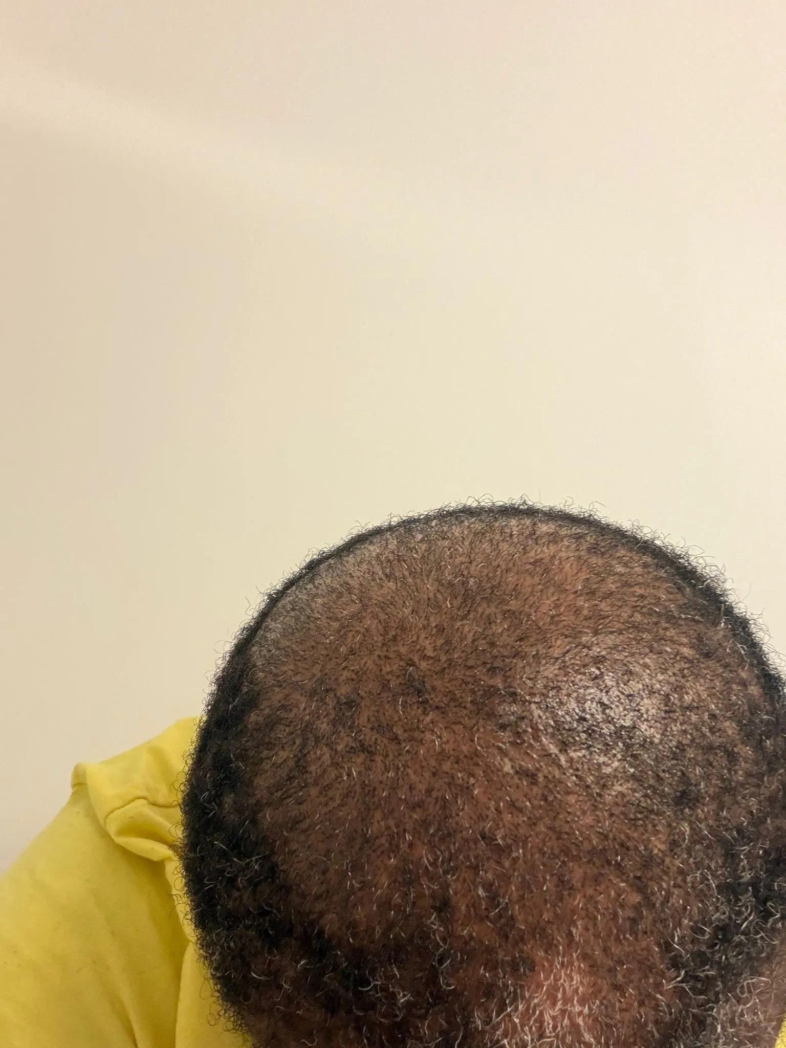 Hair growth products